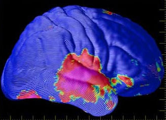 Illustration for article titled This Is What Game Consoles Really Do To Your Brain